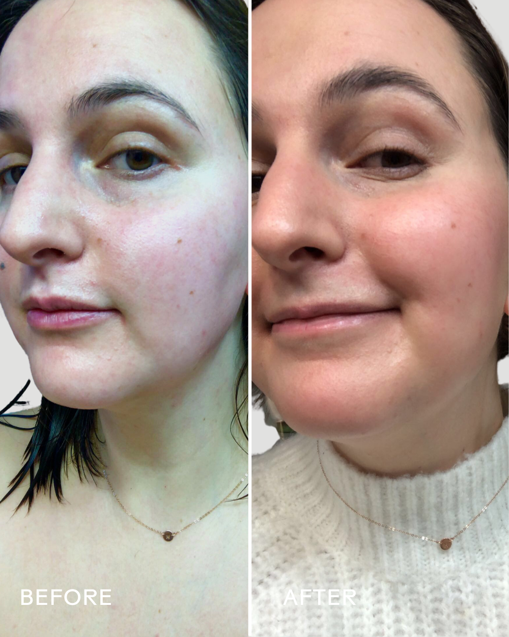 SkinHero™ Calendula + 2% Bakuchiol Bio-Retinol Serum